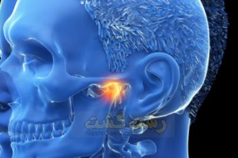 آرتروز فک